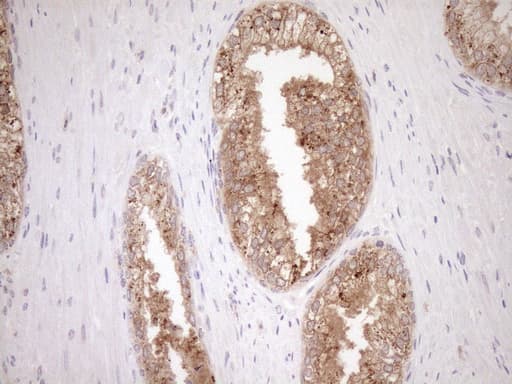 Monoclonal Mouse anti-Human CSA / ERCC8 Antibody (clone OTI1G2, IHC, WB)