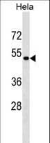 KRR1 Antibody (aa1-30)