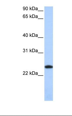 PathPlus™ Polyclonal Rabbit anti-Human FTL / Ferritin Light Chain Antibody (C-Terminus, IHC, WB)