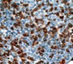 ZAP70 Antibody (clone 2F3.2)