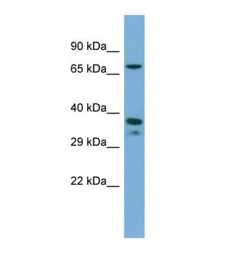 NR2E1 / TLX Antibody (aa283-332)