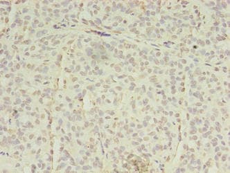 EPHA7 / EPH Receptor A7 Antibody
