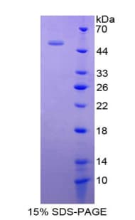 Human IFNA5 / Interferon Alpha 5 Protein (Recombinant His-GST)