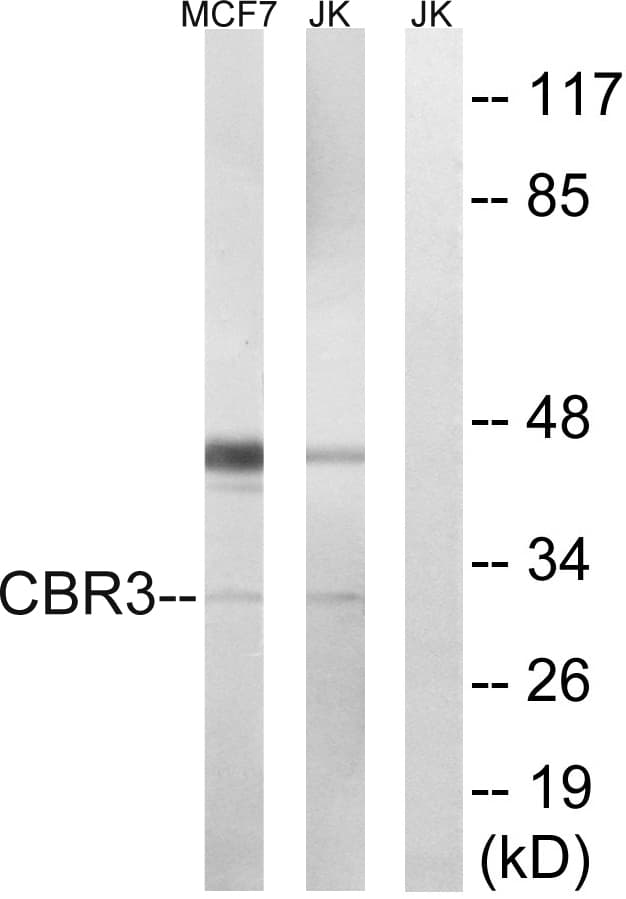 CBR3 Antibody (aa151-200)