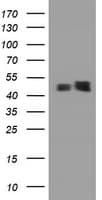 PAI-RBP1 / SERBP1 Antibody (aa1-262, clone OTI1E7)