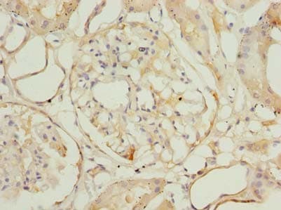 ROGDI Antibody