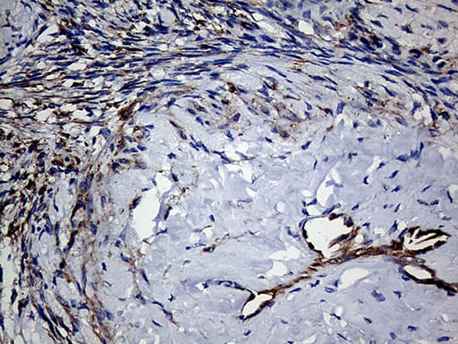 Monoclonal Mouse anti-Human TGM2 / Transglutaminase 2 Antibody (clone OTI4H5, IHC, WB)