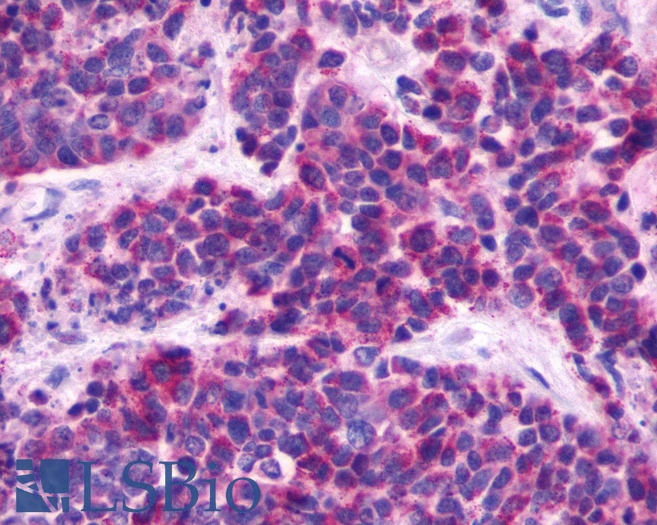 PathPlus™ Polyclonal Rabbit anti-Human MRGPRE / MRGE Antibody (C-Terminus, IHC)