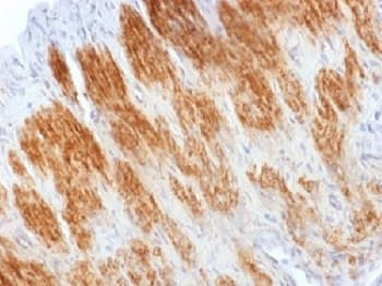 Calponin Antibody