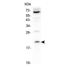 IL13 Antibody