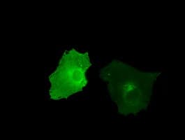 TLDC1 / KIAA1609 Antibody (clone OTI12G10)