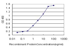 CRYGD / CCP Antibody (clone 4E12)