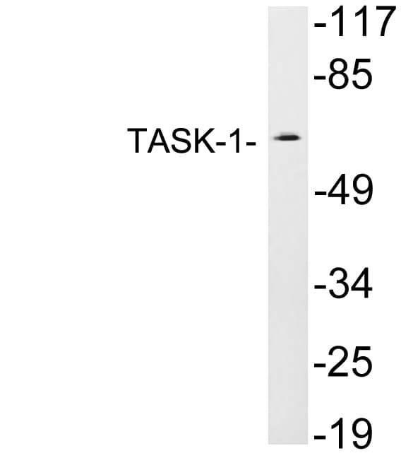 KCNK3 / OAT1 Antibody (aa47-96)