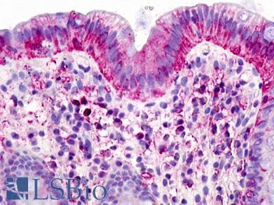 PathPlus™ Polyclonal Rabbit anti-Human GPR160 Antibody (Transmembrane Domain, IHC)