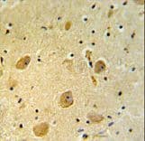 PARP16 Antibody (aa215-244)