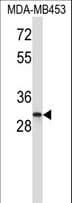 Polyclonal Rabbit anti-Human ING1 Antibody (aa1-30, WB)