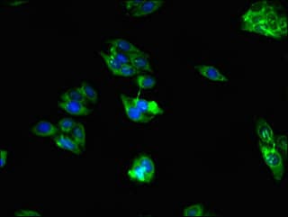 Polyclonal Rabbit anti-Human RAB39B Antibody