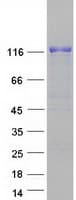 Human MAN2B1 / LAMAN Protein (Recombinant Myc-DDK (Flag))