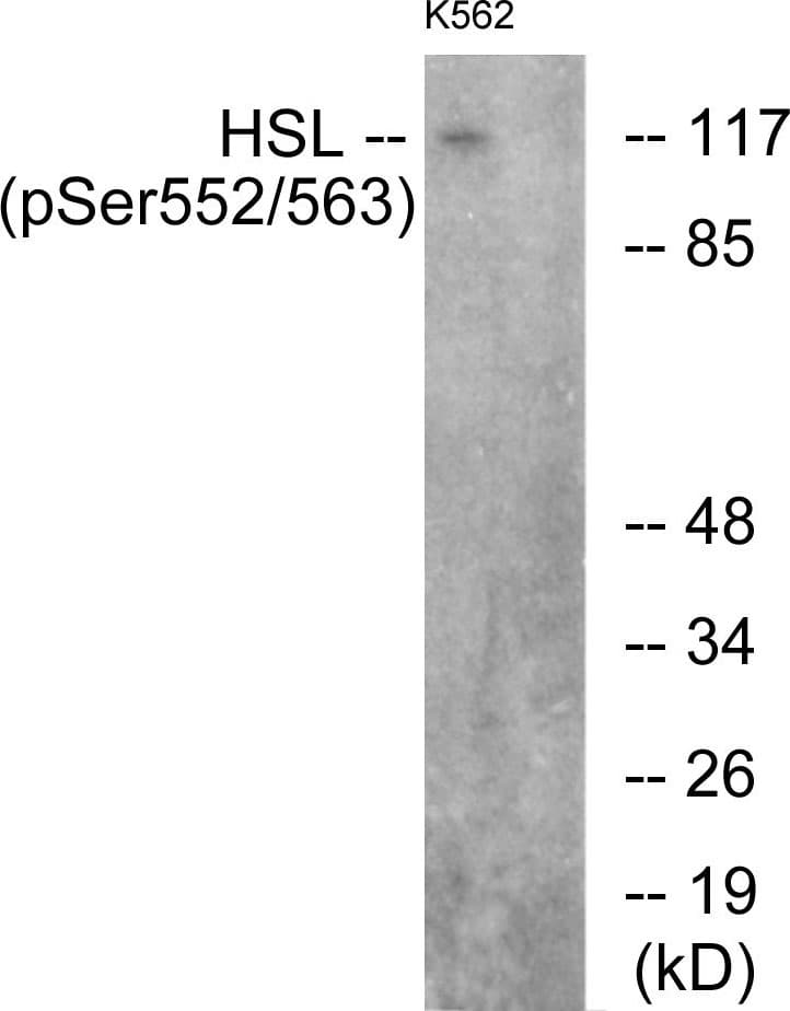 LIPE / HSL Antibody (phospho-Ser552)