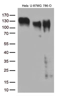 ITGB1 / Integrin Beta 1 / CD29 Antibody (clone OTI9B5)