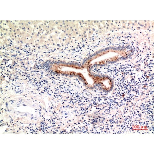 Complement C4a+b Antibody (721-770 aa, Internal)