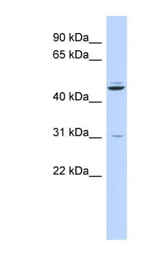 ZNF238 Antibody (aa107-156)