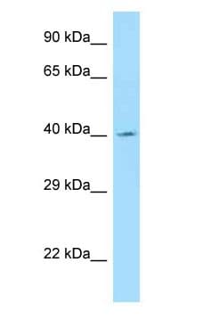 ANGPTL5 Antibody (aa29-78)