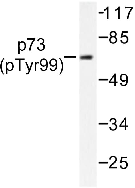 Polyclonal Rabbit anti-Human TP73 / p73 Antibody (phospho-Tyr99, IHC, WB)