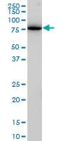 Monoclonal Mouse anti-Human CLINT1 Antibody (clone 1E6, IHC, WB)