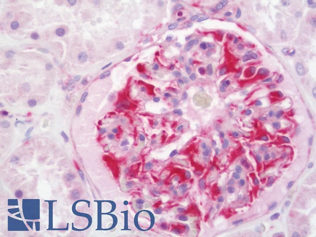 IHC-plus™ Polyclonal Rabbit anti-Human ABCD4 Antibody (aa98-147, IHC, WB)