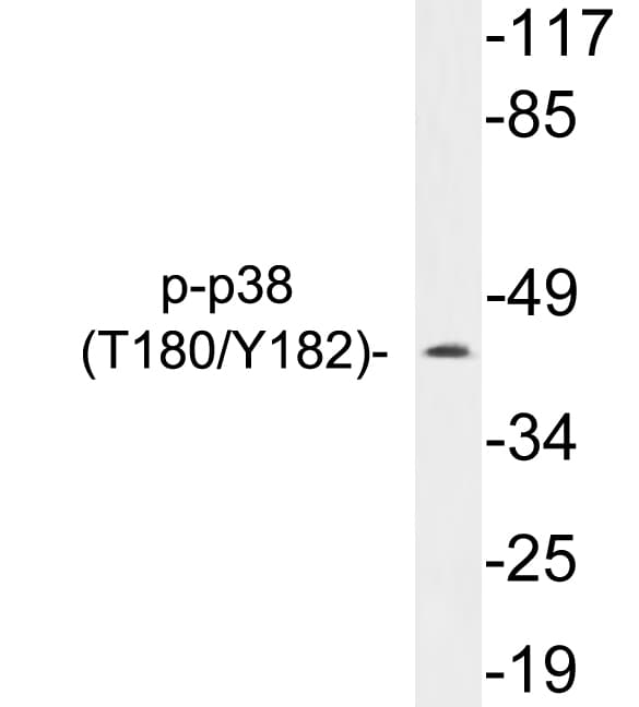 MAPK14 / p38 Antibody (phospho-Thr180/Tyr182)