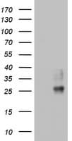 Monoclonal Mouse anti-Human CD63 Antibody (clone OTI5D9, WB)