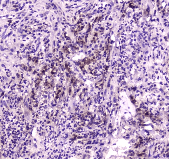 NPC2 Antibody