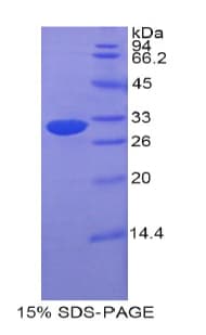 Mouse ETFA Protein (Recombinant His-T7)