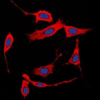 COL1A2 / Collagen I Alpha 2 Antibody (N-Terminus)