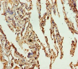 SLC34A1 / NPT2 Antibody