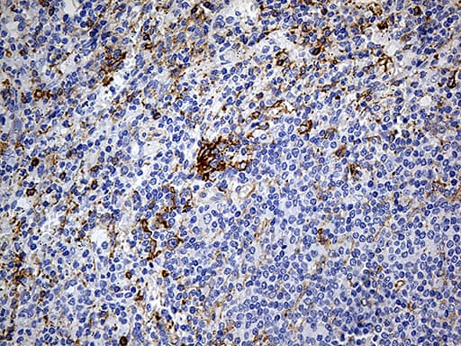 DBN1 / Drebrin Antibody (aa2-240, clone OTI4B3)