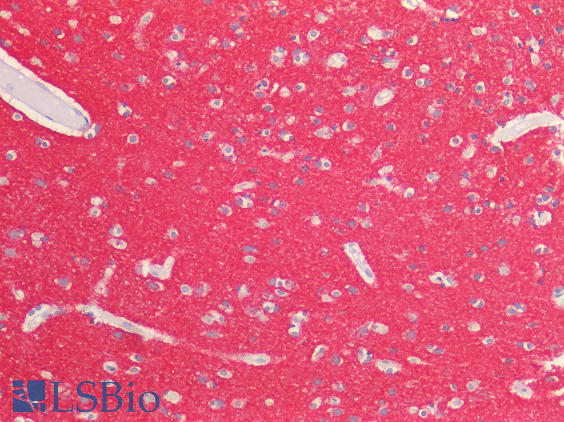 IHC-plus™ SNAP25 Antibody