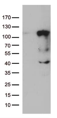 LCA5 Antibody (clone OTI1A3)