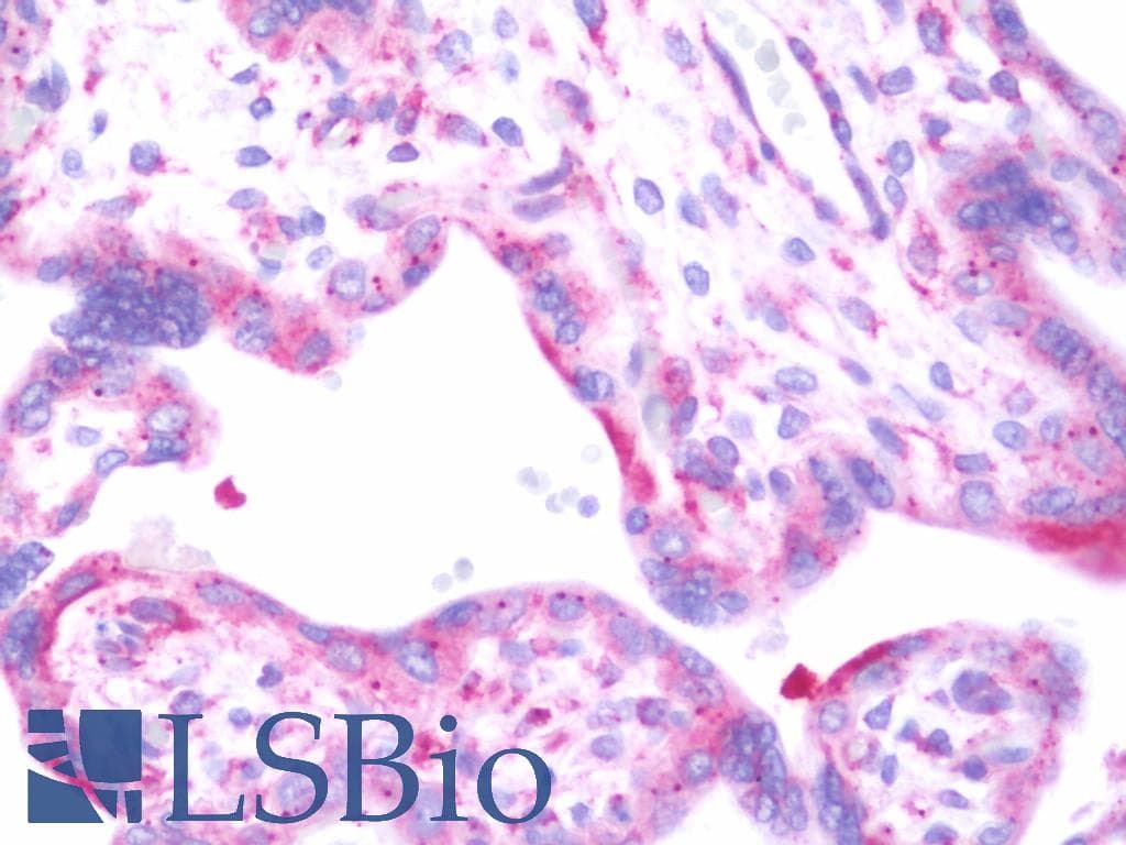 IHC-plus™ LAMB3 / Laminin Beta 3 Antibody (aa644-960)