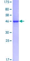 Human KRT81 / Keratin 81 / KRTHB1 Protein (Recombinant GST)