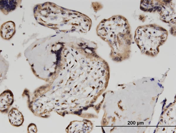 ZSCAN29 Antibody (clone 2E8)