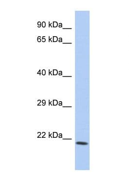 TNFSF15 / TL1A / VEGI Antibody (aa103-152)