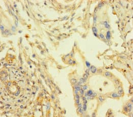 Polyclonal Rabbit anti-Human ARHGAP27 Antibody