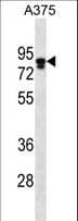 MLPH / Melanophilin Antibody (aa541-569)