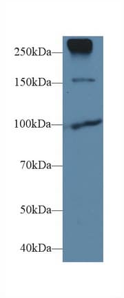 CDH1 / E Cadherin Antibody (aa155-882, FITC)
