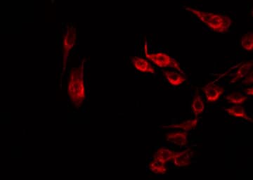 Polyclonal Rabbit anti-Human DDX19B Antibody (IF, WB)
