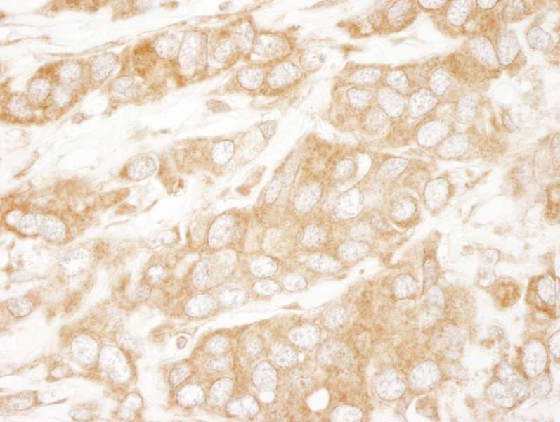 Polyclonal Rabbit anti-Human PTEN Antibody (C-Terminus, IHC, IF)