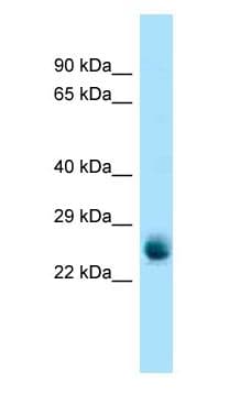 RAB5A / RAB5 Antibody (aa92-141, HRP)