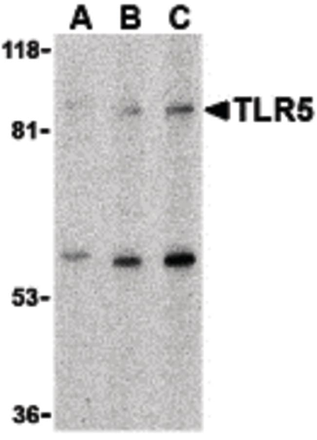 IHC-plus™ Polyclonal Rabbit anti-Human TLR5 Antibody (IHC, IF, WB)